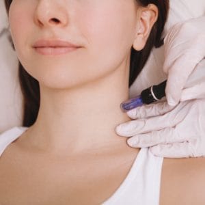 DermaPen