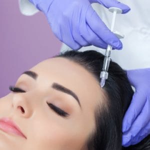 البلازما الغنية بالصفائح الدموية - الشعر