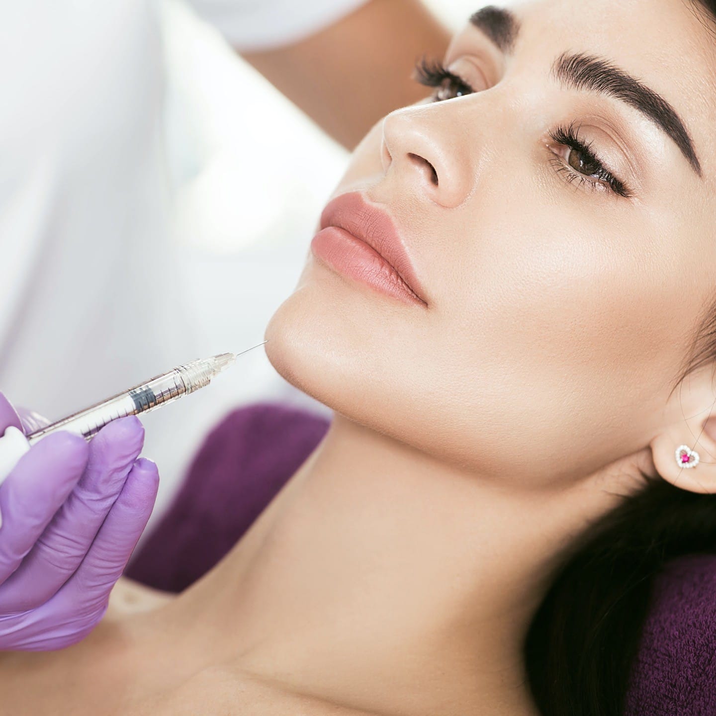 Chin augmentation