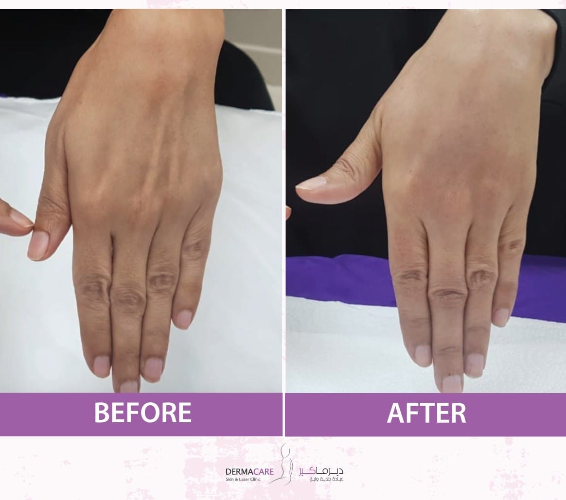 Skin Rejuvenation - Image 3