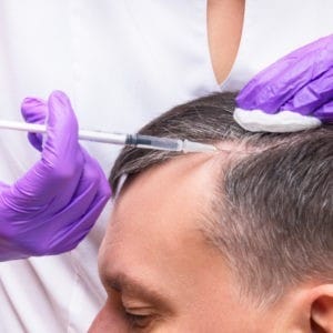 حقن الميزوثيرابي لعلاج تساقط الشعر وفروة الرأس