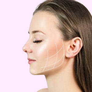 Jawline reshaping