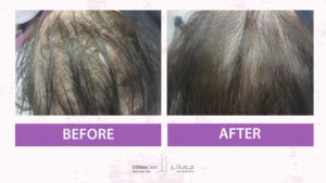 Hair Treatments