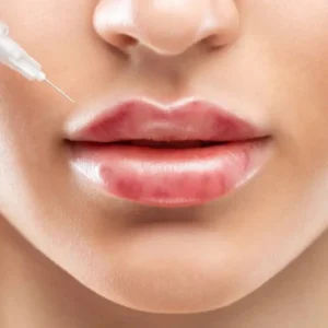 الكدمات بعد الحقن التجميلي