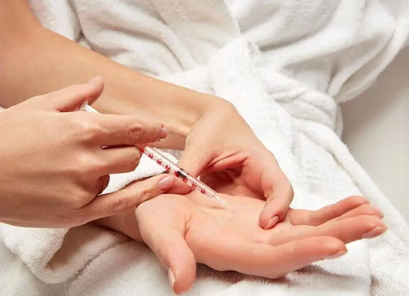 علاج التعرق الزائد بالبوتوكس في الصيف
